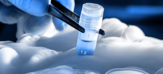 Najbolja banka matičnih ćelija kako odabrati